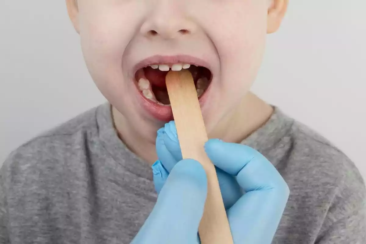 Niño con la boca abierta siendo examinado por un médico